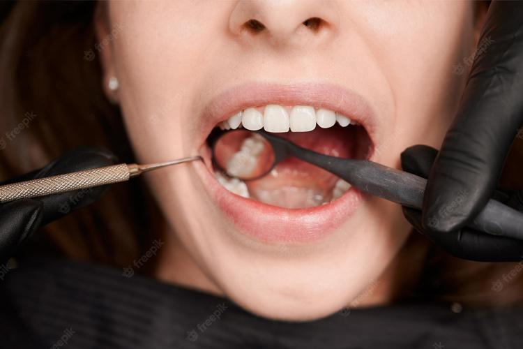 Conheça 7 hábitos aparentemente inofensivos que prejudicam seus dentes